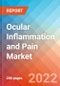 Ocular Inflammation and Pain - Market Insight, Epidemiology and Market Forecast -2032 - Product Image