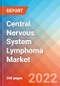 Central Nervous System Lymphoma - Market Insight, Epidemiology and Market Forecast -2032 - Product Thumbnail Image