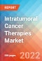 Intratumoral Cancer Therapies - Market Insight, Epidemiology And Market Forecast - 2032 - Product Image