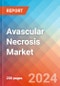 Avascular Necrosis - Market Insight, Epidemiology and Market Forecast -2032 - Product Thumbnail Image