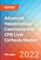 Advanced Hepatocellular Carcinoma with CPB Liver Cirrhosis - Market Insight, Epidemiology and Market Forecast -2032 - Product Image
