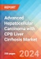 Advanced Hepatocellular Carcinoma with CPB Liver Cirrhosis - Market Insight, Epidemiology and Market Forecast - 2034 - Product Image