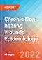 Chronic Non-healing Wounds - Epidemiology Forecast to 2032 - Product Image