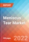 Meniscus Tear - Market Insight, Epidemiology and Market Forecast -2032 - Product Thumbnail Image