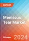 Meniscus Tear - Market Insight, Epidemiology and Market Forecast -2032 - Product Thumbnail Image