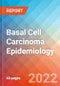 Basal Cell Carcinoma (Basal Cell Epithelioma) - Epidemiology Forecast to 2032 - Product Thumbnail Image