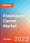 Esophageal Cancer - Market Insight, Epidemiology and Market Forecast -2032 - Product Image