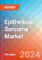 Epithelioid Sarcoma - Market Insight, Epidemiology and Market Forecast -2032 - Product Thumbnail Image