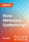 Bone Metastasis - Epidemiology Forecast to 2032 - Product Image