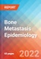 Bone Metastasis - Epidemiology Forecast to 2032 - Product Thumbnail Image