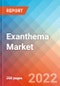 Exanthema - Market Insight, Epidemiology and Market Forecast -2032 - Product Thumbnail Image