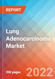 Lung Adenocarcinoma - Market Insight, Epidemiology and Market Forecast -2032- Product Image