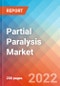 Partial Paralysis - Market Insight, Epidemiology and Market Forecast -2032 - Product Thumbnail Image