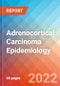 Adrenocortical Carcinoma - Epidemiology Forecast to 2032 - Product Thumbnail Image