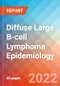 Diffuse Large B-cell Lymphoma - Epidemiology Forecast to 2032 - Product Thumbnail Image