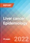 Liver cancer - Epidemiology Forecast to 2032 - Product Thumbnail Image