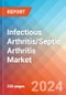 Infectious Arthritis/Septic Arthritis - Market Insight, Epidemiology and Market Forecast -2032 - Product Thumbnail Image