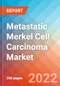 Metastatic Merkel Cell Carcinoma - Market Insight, Epidemiology and Market Forecast -2032 - Product Thumbnail Image