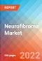 Neurofibroma - Market Insight, Epidemiology and Market Forecast -2032 - Product Thumbnail Image
