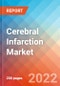 Cerebral Infarction - Market Insight, Epidemiology and Market Forecast -2032 - Product Image