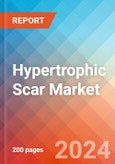 Hypertrophic Scar - Market Insight, Epidemiology and Market Forecast -2032- Product Image