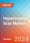 Hypertrophic Scar - Market Insight, Epidemiology and Market Forecast -2032 - Product Thumbnail Image