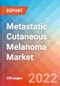 Metastatic Cutaneous Melanoma - Market Insight, Epidemiology and Market Forecast -2032 - Product Thumbnail Image