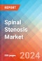 Spinal Stenosis - Market Insight, Epidemiology and Market Forecast -2032 - Product Thumbnail Image