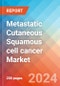 Metastatic Cutaneous Squamous cell cancer - Market Insight, Epidemiology and Market Forecast -2032 - Product Thumbnail Image