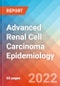 Advanced Renal Cell Carcinoma (RCC) - Epidemiology Forecast to 2032 - Product Thumbnail Image