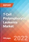 T-Cell Prolymphocytic Leukemia - Market Insight, Epidemiology and Market Forecast -2032 - Product Image
