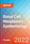 Basal Cell Neoplasms - Epidemiology Forecast to 2032 - Product Thumbnail Image