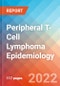 Peripheral T-Cell Lymphoma - Epidemiology Forecast - 2032 - Product Thumbnail Image