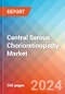 Central Serous Chorioretinopathy - Market Insight, Epidemiology and Market Forecast - 2034 - Product Thumbnail Image