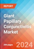 Giant Papillary Conjunctivitis - Market Insight, Epidemiology and Market Forecast -2032- Product Image