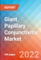 Giant Papillary Conjunctivitis - Market Insight, Epidemiology and Market Forecast -2032 - Product Thumbnail Image