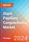 Giant Papillary Conjunctivitis - Market Insight, Epidemiology and Market Forecast -2032 - Product Thumbnail Image