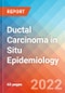 Ductal Carcinoma in Situ - Epidemiology Forecast - 2032 - Product Thumbnail Image