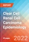 Clear Cell Renal Cell Carcinoma (ccRCC) - Epidemiology Forecast - 2032 - Product Thumbnail Image