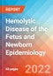 Hemolytic Disease of the Fetus and Newborn - Epidemiology Forecast - 2032 - Product Thumbnail Image