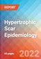 Hypertrophic Scar - Epidemiology Forecast - 2032 - Product Thumbnail Image