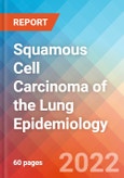 Squamous Cell Carcinoma of the Lung - Epidemiology Forecast - 2032- Product Image