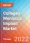 Collagen Meniscus Implant Market Insights, Competitive Landscape and Market Forecast-2027 - Product Thumbnail Image