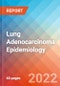 Lung Adenocarcinoma - Epidemiology Forecast - 2032 - Product Thumbnail Image