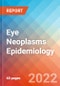 Eye Neoplasms - Epidemiology Forecast to 2032 - Product Thumbnail Image