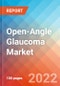 Open-Angle Glaucoma (OAG) - Market Insights, Competitive Landscape and Market Forecast-2027 - Product Image