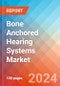 Bone Anchored Hearing Systems - Market Insights, Competitive Landscape and Market Forecast-2030 - Product Image