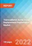 Transcatheter Aortic Valve Replacement/Implantation - Market Insights, Competitive Landscape and Market Forecast-2027- Product Image