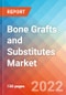 Bone Grafts and Substitutes - Market Insights, Competitive Landscape and Market Forecast-2027 - Product Image
