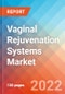Vaginal Rejuvenation Systems - Market Insights, Competitive Landscape and Market Forecast-2027 - Product Image